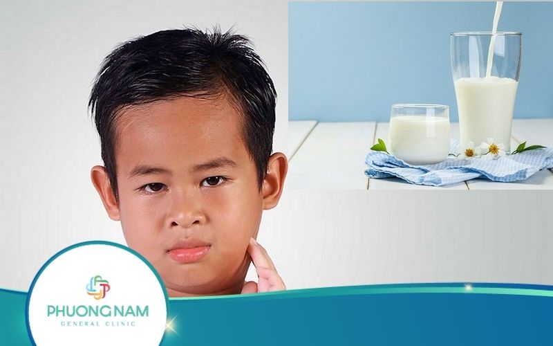 [Giải Đáp] Bị Quai Bị Có Được Uống Sữa Không? Cần Kiêng Ăn Gì?