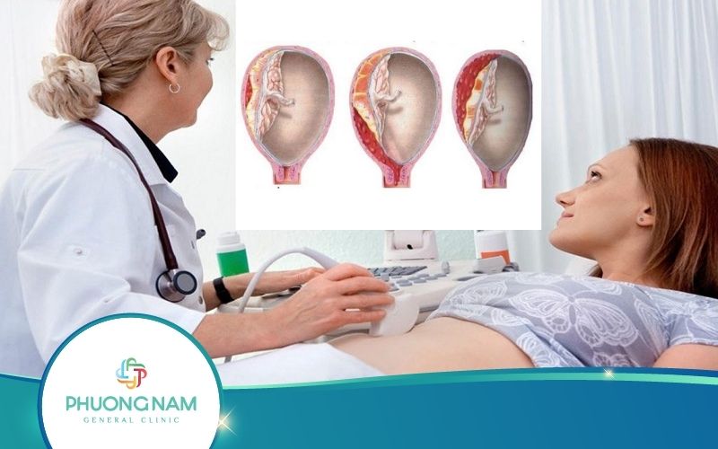 Bóc Tách Túi Thai Nhưng Không Ra Máu Liệu Có Nguy Hiểm?