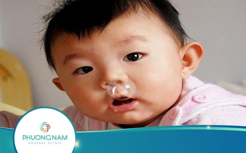 Top 3 Cách Chữa Cảm Cúm Cho Trẻ Sơ Sinh Tại Nhà