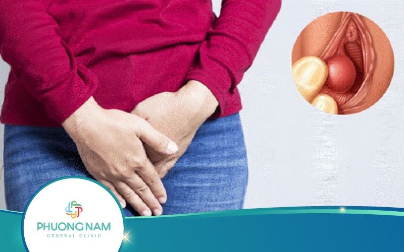Thịt Dư Vùng Kín – Dấu Hiệu Bệnh Lý Nguy Hiểm