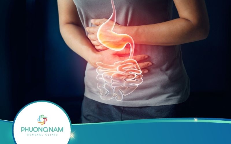 Trào Ngược Dạ Dày – Nguyên Nhân, Triệu Chứng, Cách Điều Trị