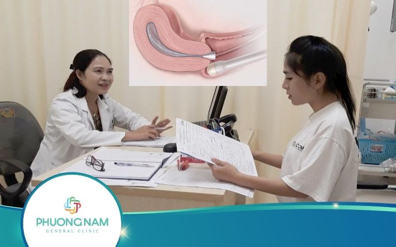 Cách Đọc Kết Quả Siêu Âm Đầu Dò Chính Xác Nhất