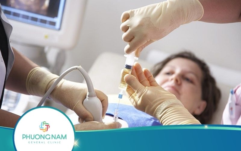 Chọc Ối Có Ảnh Hưởng Đến Thai Nhi Không? – Bác Sĩ Giải Đáp