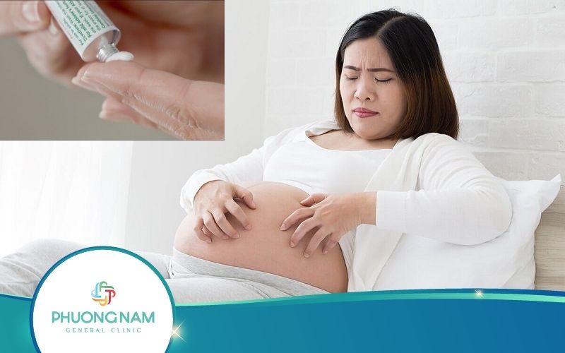Mang Bầu Có Được Bôi Thuốc Ngoài Da Không? – Bác Sĩ Giải Đáp