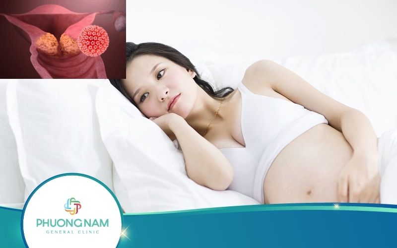 [Giải Đáp] Sùi Mào Gà Có Ảnh Hưởng Đến Thai Nhi Không?
