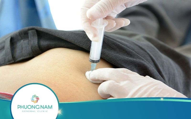 Tiêm Mông Có Nguy Hiểm Không? Kỹ Thuật Tiêm Mông Ra Sao?