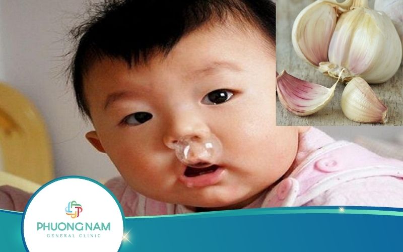 Top 5 Cách Trị Cảm Cúm Cho Trẻ Sơ Sinh Bằng Tỏi