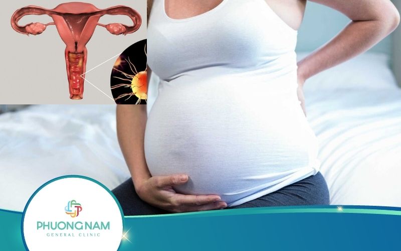Viêm Nhiễm Phụ Khoa Có Ảnh Hưởng Đến Thai Nhi Không?