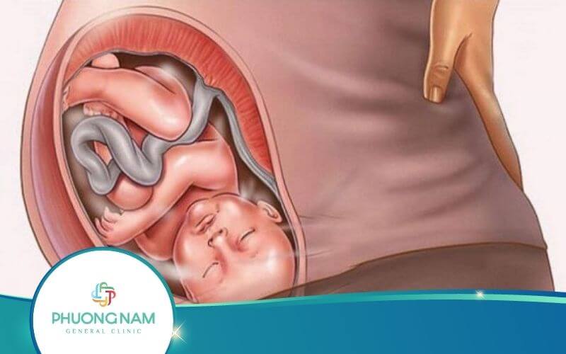 Dấu Hiệu Thai Quay Đầu Mẹ Bầu Cần Biết