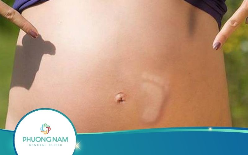 Thai Nhi Đạp Nhiều Có Tốt Không? – Giải Đáp Cho Mẹ Bầu