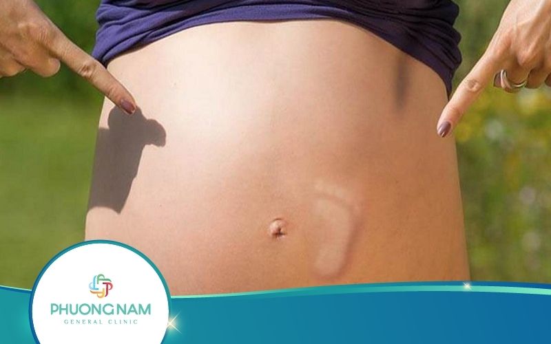 Thai Nhi Đạp Trong Bụng Mẹ Có Ý Nghĩa Như Thế Nào?