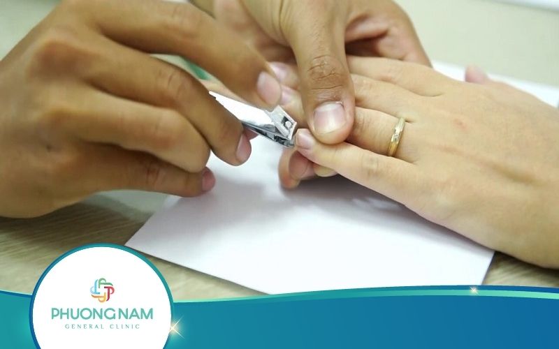 [Hỏi Đáp] Xét Nghiệm ADN Bằng Móng Tay Có Chính Xác Không?