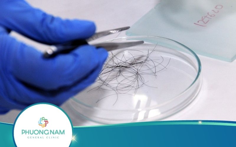 Xét Nghiệm ADN Cần Những Gì? Cách Lấy Mẫu Như Thế Nào?