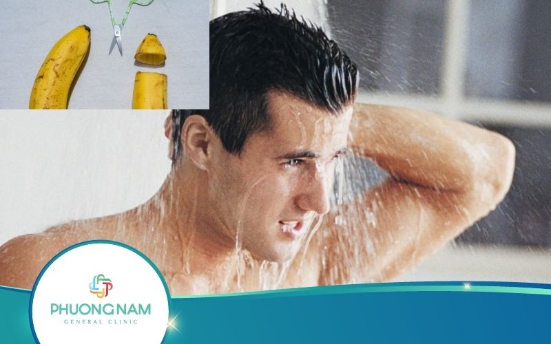 Cắt Bao Quy Đầu Bao Lâu Thì Tắm Được – Bác Sĩ Giải Đáp