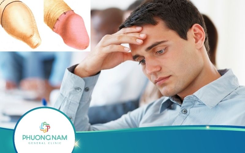 [Giải Đáp] Cắt Bao Quy Đầu Có Đau Không?