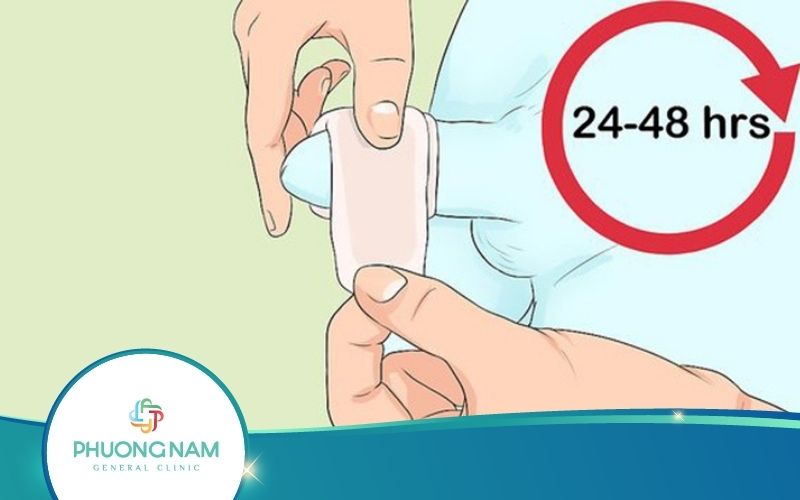 8 Cách Chăm Sóc Trẻ Sau Khi Cắt Bao Quy Đầu Hiệu Quả