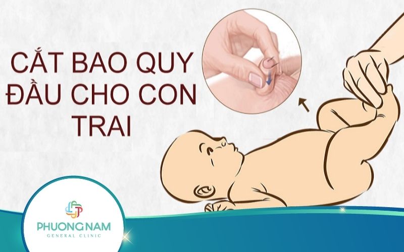 Có Nên Cắt Bao Quy Đầu Cho Trẻ Không? Khi Nào Nên Cắt?