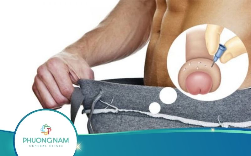 Sau Khi Cắt Bao Quy Đầu Bị Mọng Nước Có Nguy Hiểm Không?