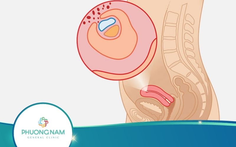 Thai 4 Tuần Tuổi Phát Triển Ra Sao? Và Lời Khuyên Từ Bác Sĩ