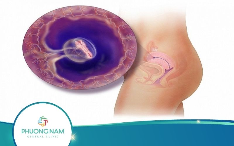 Thai Nhi 1 Tuần Tuổi Và Lời Khuyên Từ Bác Sĩ Mẹ Nên Biết