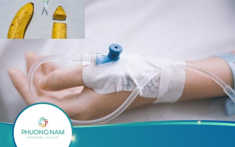 Truyền Dịch Sau Khi Cắt Bao Quy Đầu Để Làm Gì? Có Cần Thiết Không?