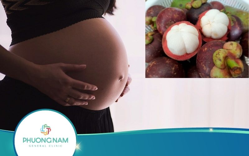 Bà Bầu Ăn Măng Cụt Được Không? Nên Ăn Thế Nào Cho Đúng?