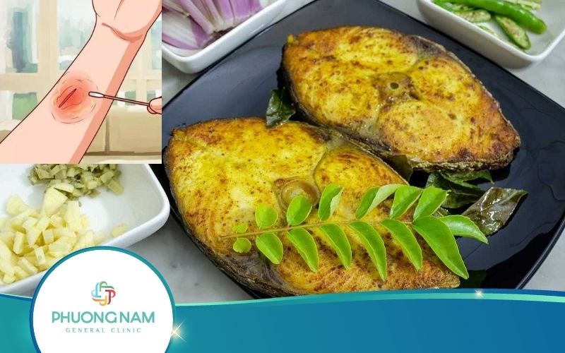 [Giải Đáp] Bị Vết Thương Hở Có Nên Ăn Cá Không?