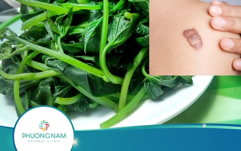 Ăn Rau Lang Có Bị Lồi Thịt Không? Thực Hư Ra Sao?
