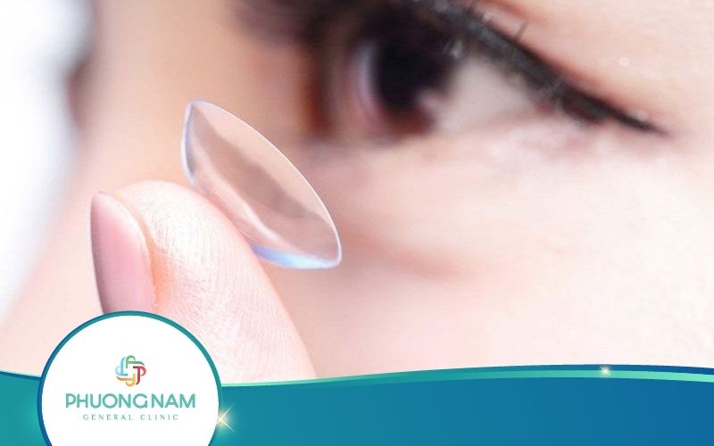 Kính Cận Áp Tròng Bao Nhiêu Tiền? Xem Thông Tin Về Lens Cận!