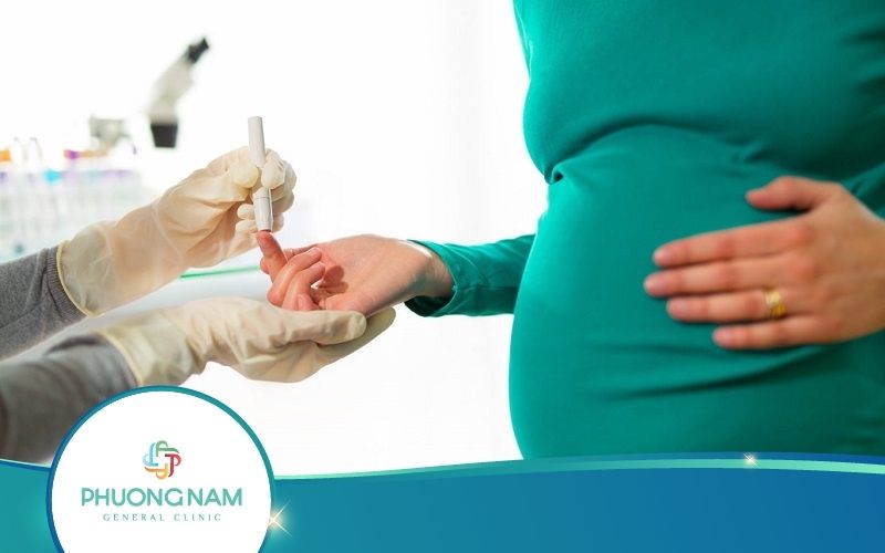 Xét Nghiệm Tiểu Đường Thai Kỳ – Thông Tin Từ A Đến Z