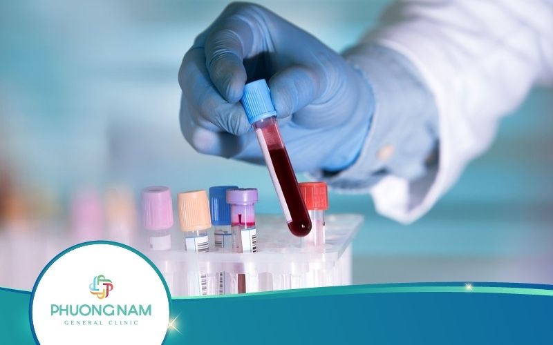 Vì Sao Có Hiện Tượng Âm Tính Giả Và Dương Tính Giả?