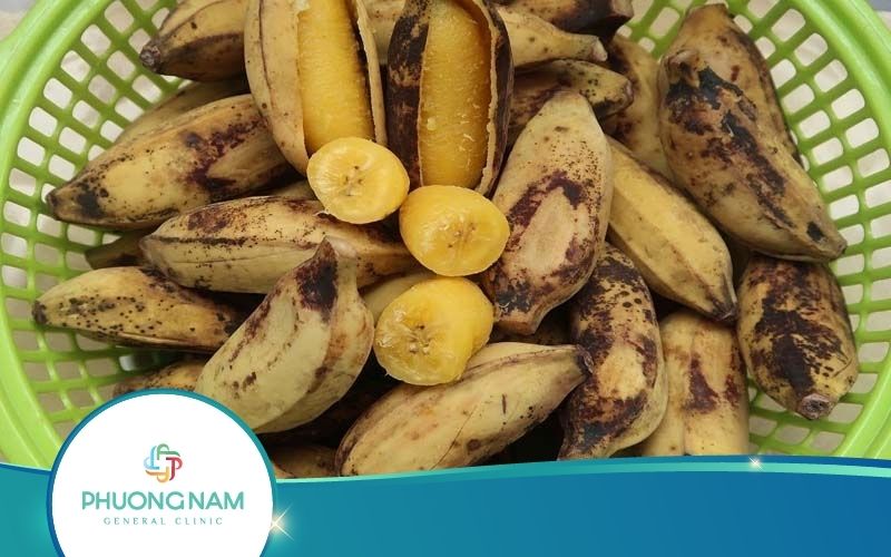 Chuối Luộc Bao Nhiêu Calo? Vì Sao Ăn Chuối Luộc Giảm Cân?
