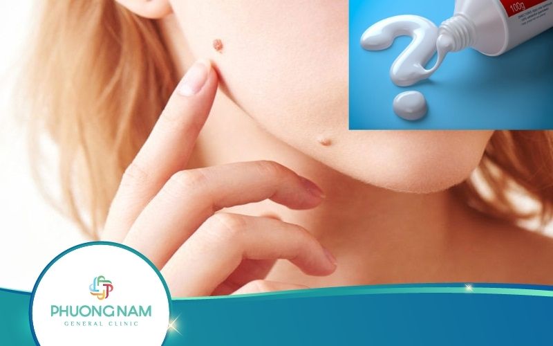 Tẩy Nốt Ruồi Bằng Kem Đánh Răng Có Hiệu Quả Không?
