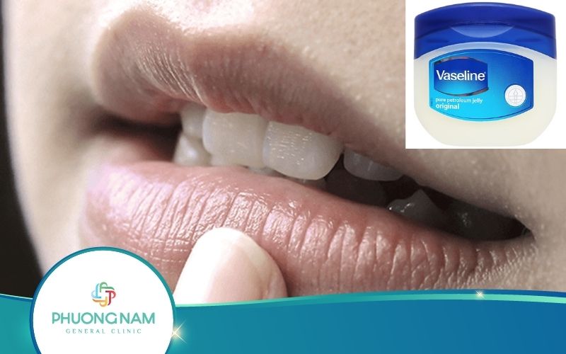 Vaseline Có Trị Thâm Môi Không? Vaseline Có Công Dụng Gì?