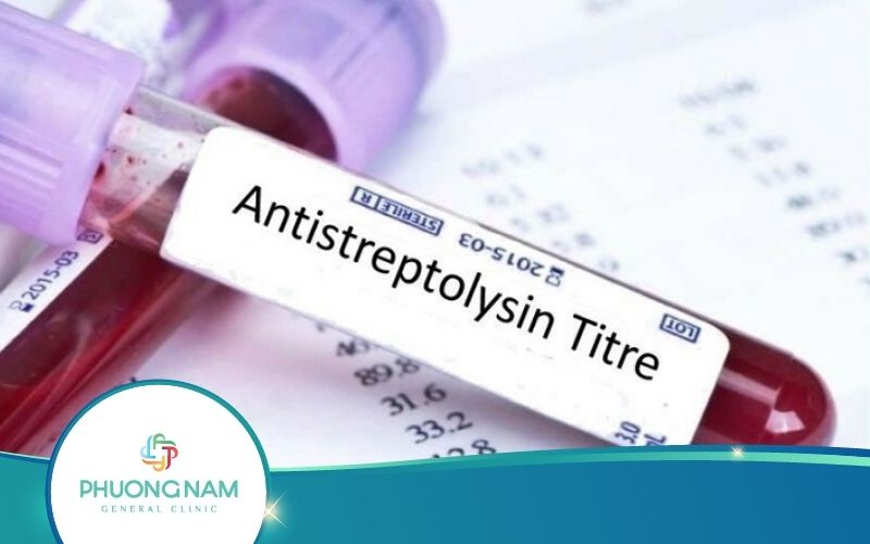 Xét Nghiệm ASLO Là Gì? Kết Quả Xét Nghiệm Có Ý Nghĩa Gì?