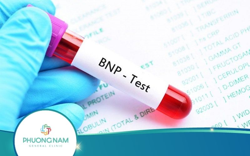 Xét Nghiệm BNP Là Gì? Khi Nào Cần Chỉ Định Thực Hiện?