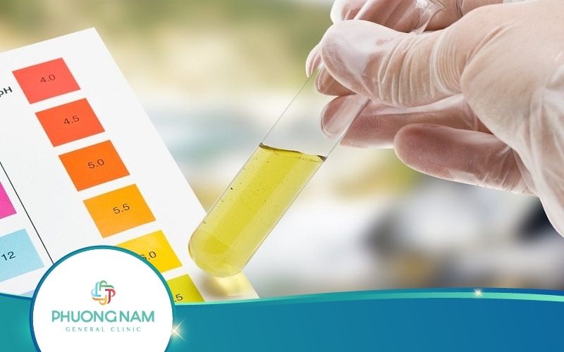 Những Loại Xét Nghiệm Chức Năng Thận Hiệu Quả Và Phổ Biến