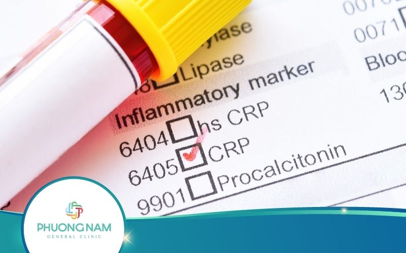 Xét Nghiệm CRP Là Gì? Xét Nghiệm CRP Bao Nhiêu Tiền?
