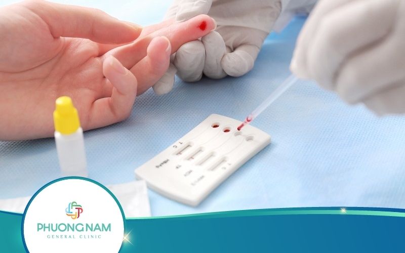 Xét Nghiệm Giang Mai Là Gì? Thực Hiện Như Thế Nào?