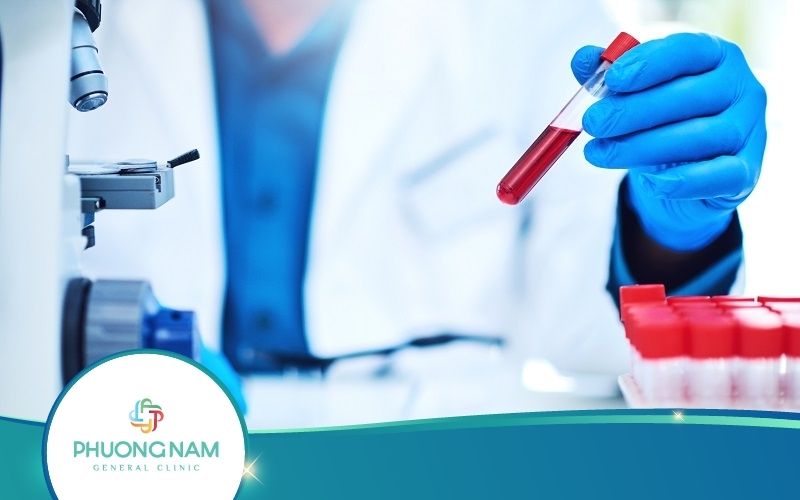 Xét Nghiệm Hồng Cầu Lưới Là Gì? Quy Trình Thực Hiện Ra Sao?