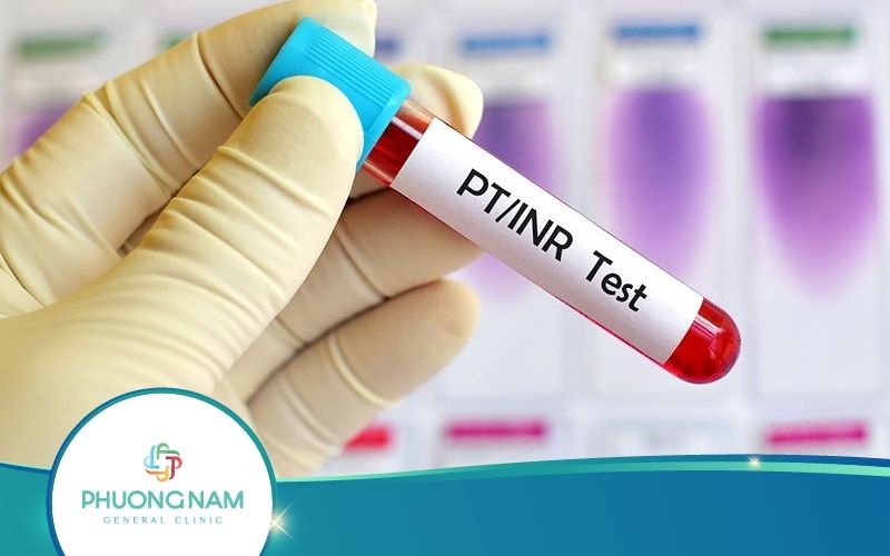 Xét Nghiệm INR Là Gì? Quy Trình Thực Hiện Ra Sao?