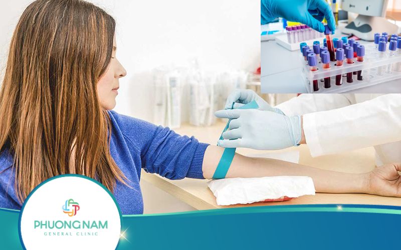 Xét Nghiệm Nội Tiết Chuẩn Bị Mang Thai – Những Điều Cần Biết