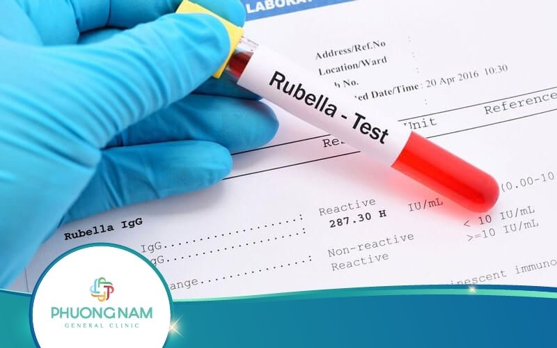 Xét Nghiệm Rubella Là Gì? Kết Quả Có Ý Nghĩa Ra Sao?