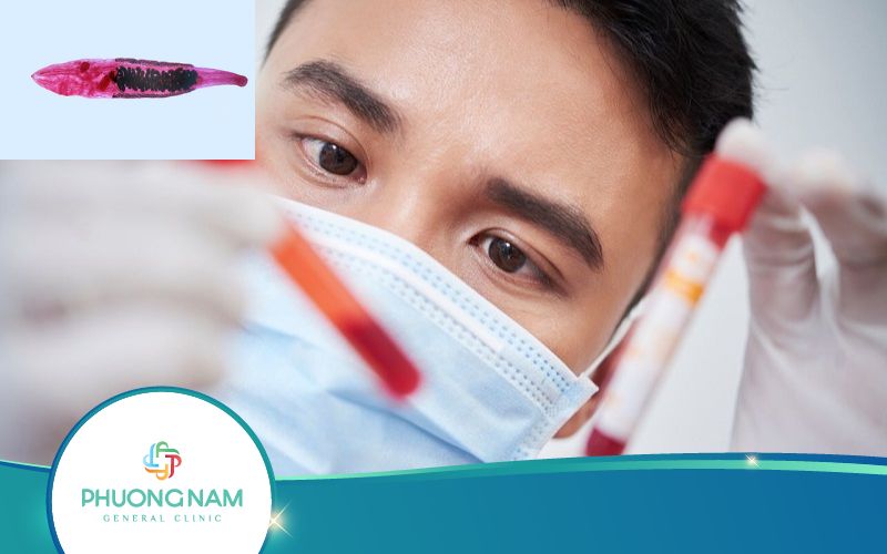 Xét Nghiệm Sán Lá Gan – Những Điều Quan Trọng Cần Biết