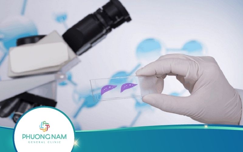 Xét Nghiệm Sinh Thiết Là Gì? Quá Trình Thực Hiện Ra Sao?