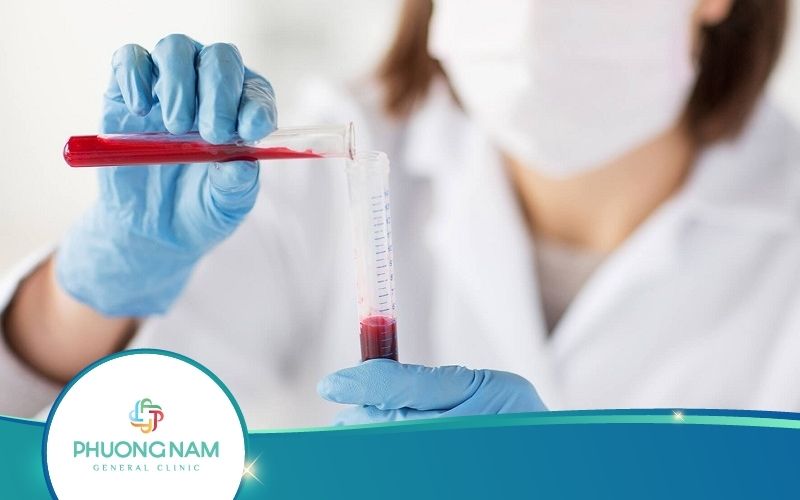 Xét Nghiệm TG Trong Chẩn Đoán Các Bệnh Về Tuyến Giáp