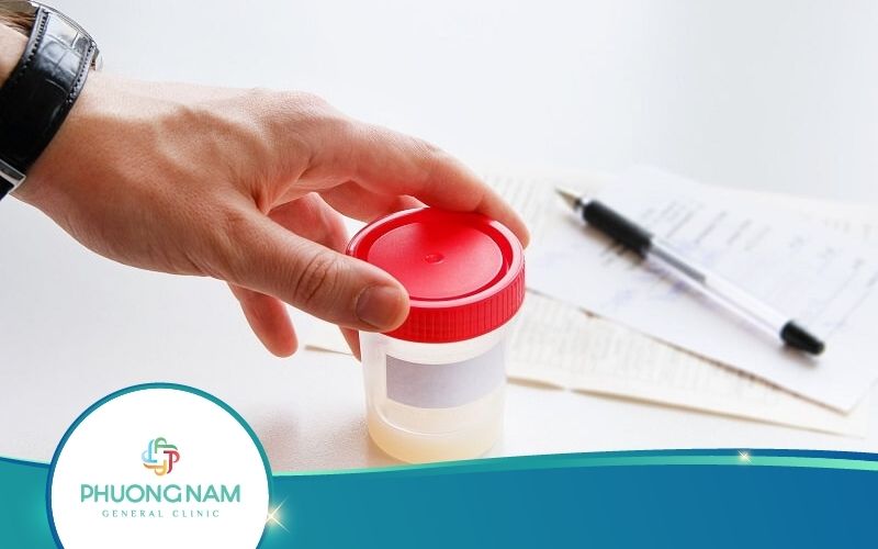 Xét Nghiệm Tinh Dịch Đồ Là Làm Những Gì?