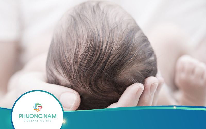 Cách Xoa Đầu Cho Trẻ Bị Méo Đầu An Toàn Và Hiệu Quả