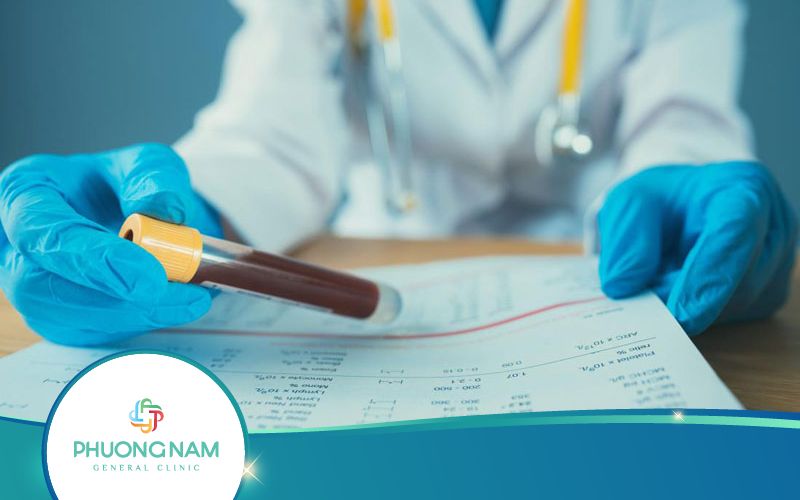 Xét Nghiệm Calcitonin Là Gì? Khi Nào Được Chỉ Định?
