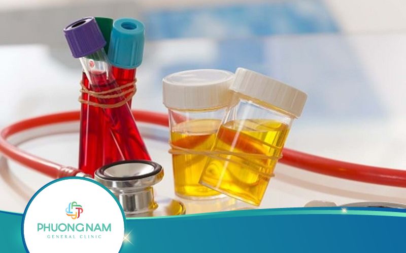 Xét Nghiệm Cận Lâm Sàng Là Gì? Có Những Loại Nào?